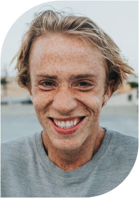 Varikozele testis, Krampfaderbruch bzw. Varizen im Hodensack ist Erweiterung den Venen am Samengebilde. Sie verursacht Infertilität und ist mit Varikozelektomie zu behandeln.