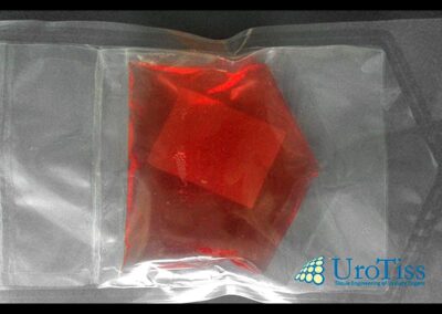 retrograde Urethrographie einer bulb&auml;ren Harnr&ouml;hrenstriktur- Harnr&ouml;hrenenge-Harnr&ouml;hrenstriktur-Urethrastriktur-Harnr&ouml;hrenverengung-Urethrotomia interna nach Sachse-Otis Urethrotomie-Mundschleimhaut-Mukocell-Tissue Engineering-ICD-10: N35-ICD-N99.1-OPS: 5-580-OPS: 5-584.8-Dr. Aref Elseweifi-Berlin