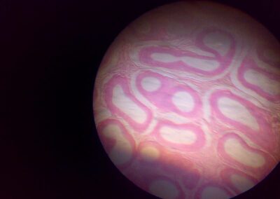 Epididymis, normales Histologie Bild einer Epididymis (Nebenhoden) vor Epididymitis-Nebenhodenentzuendung-akute Epididymitis-chronische Epididymitis-Wasserbruch-Haemospermie-Harnroehrenenge-vergroesserte Prostata-vergroesserte Vorsteherdruese-Cystitis-Blasenentzuendung-Dr. Aref Elseweifi-Berlin