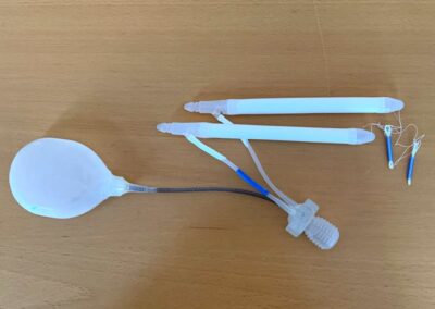 Dreiteilige hydraulische Penisprothese, der Boston Scientific bei erektile Dysfunktion-Potenzstörung-Penisprothese-Hydraulische Penisprothese-Semirigide Penisprothese-Biegsame Penisprothese-P-Shot-P-Shot pro-PRP-SKAT-Tadalafil-Sildenafil-Vardenafil-Viagra-Cialis-Caverject-Prostaglandin E1-Muse-Vakuumpumpe-Penisverkrümmung-Induratio penis plastica- Hypogonadismus-Diabetes mellitus-Hypertonie-KHK-venösen Leakage-AMS 700 MS-Tactra-Dr. Aref Elseweifi-Berlin