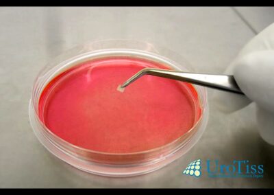 Mukocell gezüchtete eigene Gewebe “tissue engineering” für die Behandlung von Penisverkruemmung-Penisdeviation-Peniskurve-Morbus Peyronie-Induratio Penis Plastica-IPP-Schwellkoerperverhaertung-Penisaufrichtung-Penisbegradigung-Penisprothese-Potenzstoerung-Dr. Aref Elseweifi-Berlin