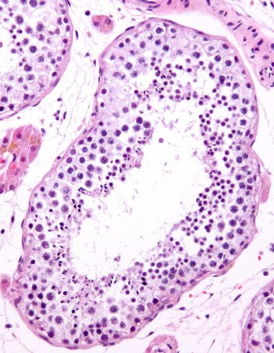 dengewebe mikroskopisches Bild einer normalen Gewebe, Seminephrous tubuli Histologie bei Leistenhoden-Kryptorchidismus-Hodentrauma-Hodenkrebs-Hodenkarzinom-Seminom-Nichtseminomatoeser Tumor-Keimzelltumor-Maldescensus Testis-Hodenhochstand-Orchiopexie-Orchiektomie-Semikasteration-Dr. Aref Elseweifi-Berlin
